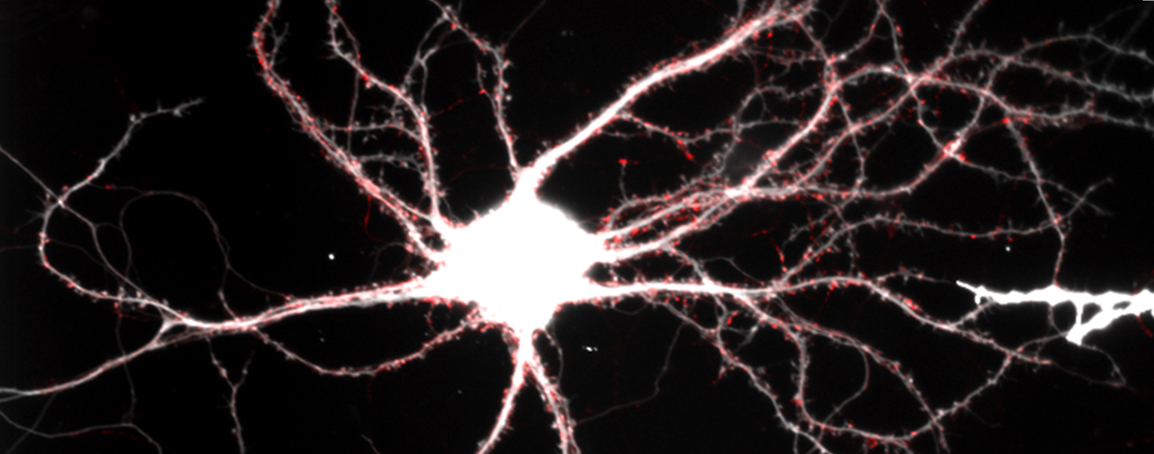 Super-resolution microscopy of functional synaptic vesicle pools