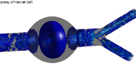 3d Modelling and haemodynamic Analysis 